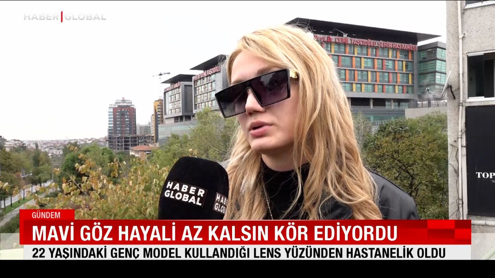 22 yaşındaki genç model kullandığı lens yüzünden hastanelik oldu